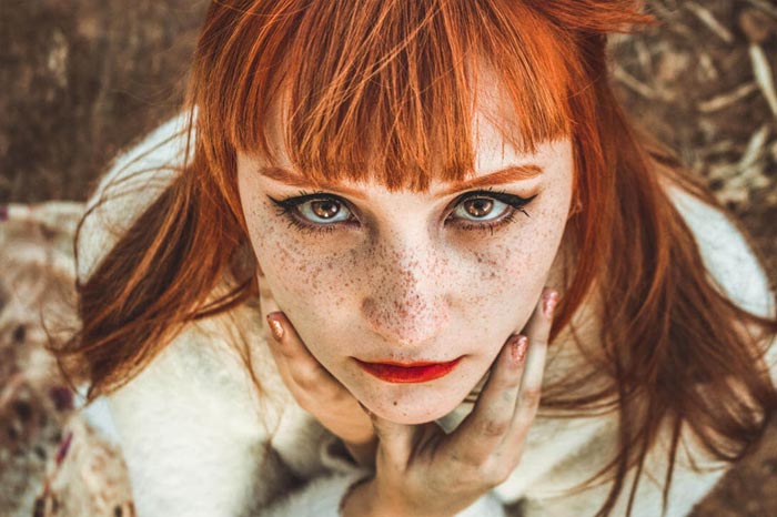 자외선과 유전, 주근깨 생기는 이유와 예방 팁